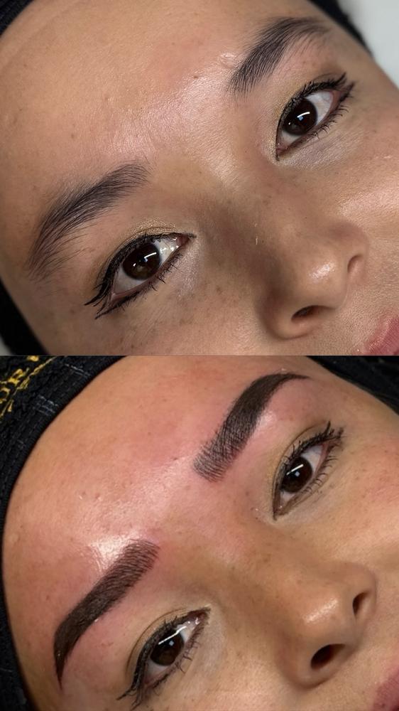 Kaş vitamini öncesi ve sonrası