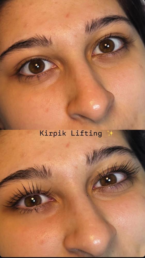 Kirpik lifting öncesi ve sonrası